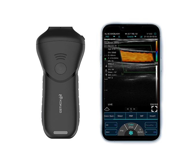 C10MS Pro USB & WiFi High-Frequency Linear Ultrasound Probe