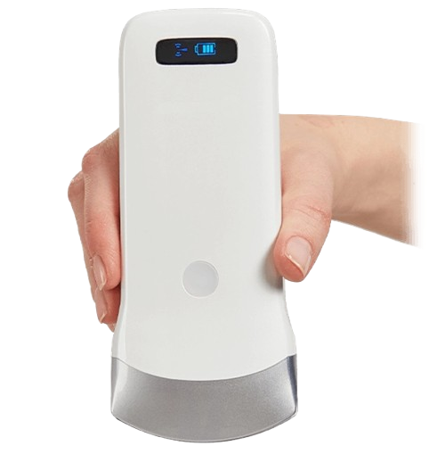 SonoSmart 16C Convex Wireless Ultrasound Probe