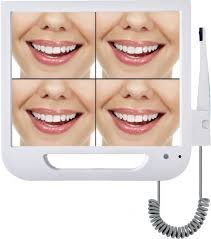 Dental Intra Oral Camera-Foshan Toye